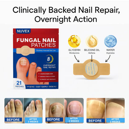 Fungal Nail Renewal Patches